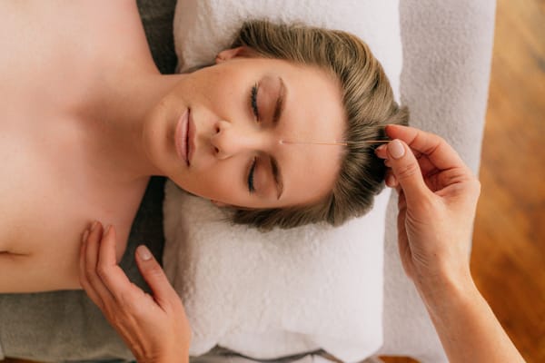 Blog 2-Holistic Practices-The Benefits of Acupuncture for Pregnancy & Postpartum Recovery.pdf-image-003 Acupuncture During Pregnancy: What Are the Benefits?